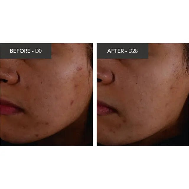 Bioderma Sébium Kerato+ acne cream for oily, acne-prone skin 30ml