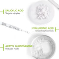 Bioderma Sébium Serum for acne-prone skin – reduces pimples, smooths fine lines, fades marks.