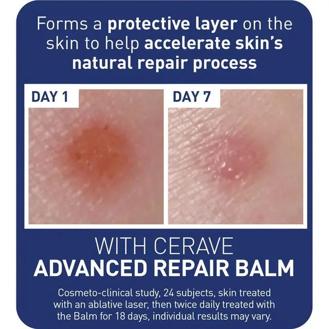 CeraVe Repair Balm 88ml hydrates, soothes & protects dry, rough skin