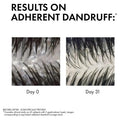 Dercos Anti-Dandruff Shampoo for Sensitive Scalp 200ml for gentle cleansing and flake-free hair