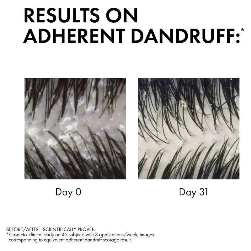 Dercos Anti-Dandruff DS Shampoo 200ml for normal to oily hair, reducing flakes and soothing scalp