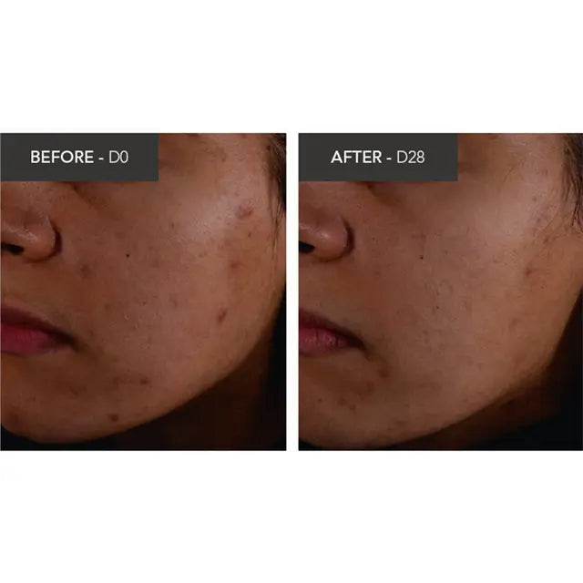 Bioderma Sebium Kerato Nonirritating Acne Cream Moisturiser suitable For Acne Prone Skin 30ml, product image 4